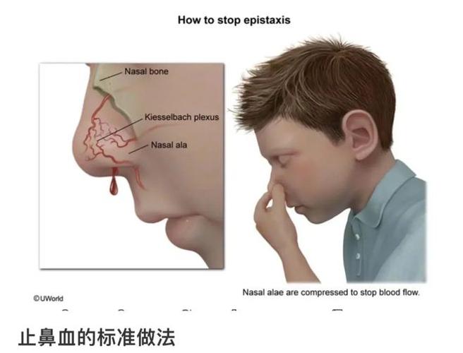 鼻子流鼻血