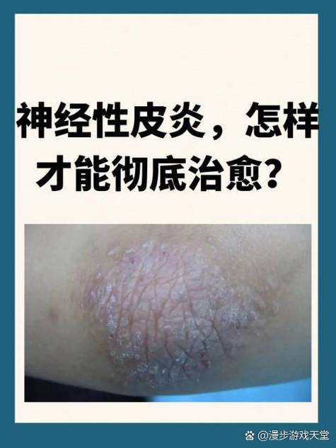 腋窝腰窝腿窝胳膊窝痒