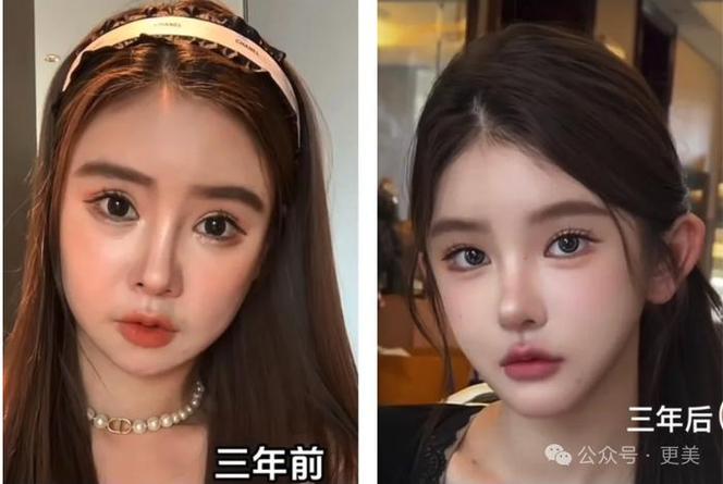 怎么变成娃娃脸截图3