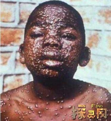 什么病毒最可怕