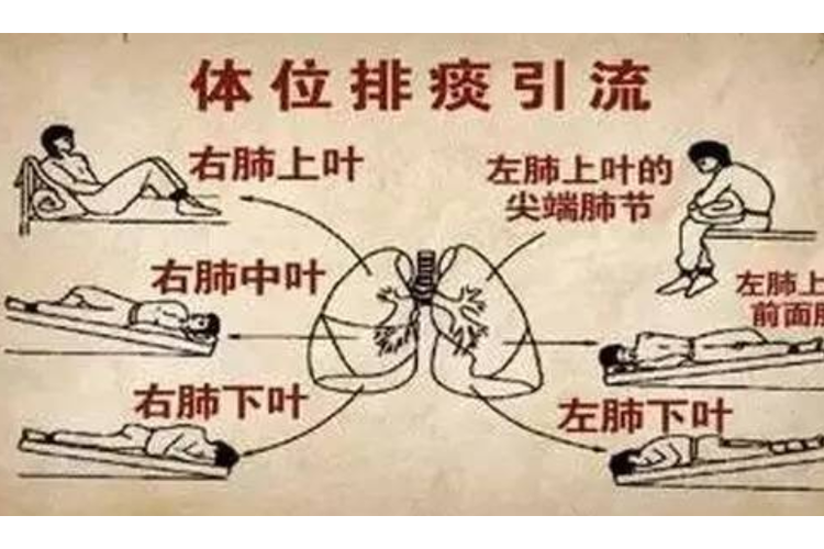 绿痰说明肺已经排出了吗