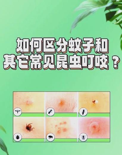 床上咬人的虫子怎么消灭