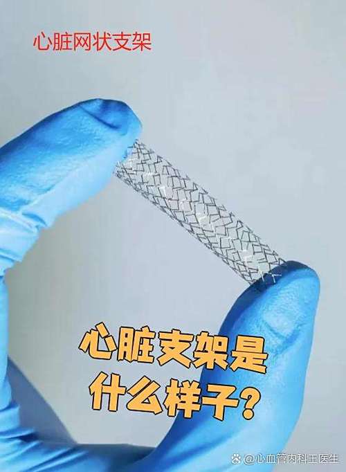 心脏支架最怕什么