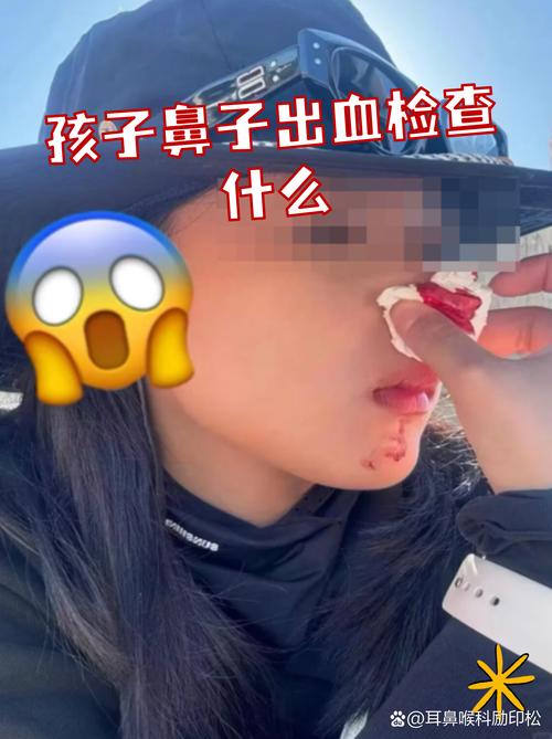 鼻子经常流鼻血图标