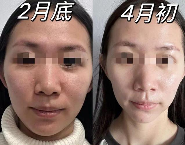 变白方法