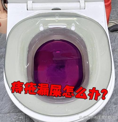 肛门漏大便是什么原因造成的