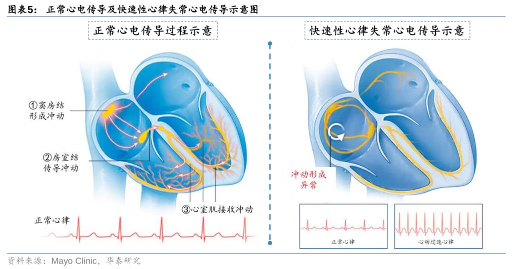 心律不齐最佳恢复方法