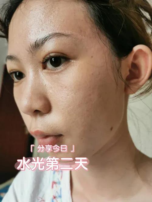 水光喷雾可以天天用吗