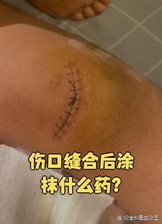 疤痕灵涂抹最佳时间