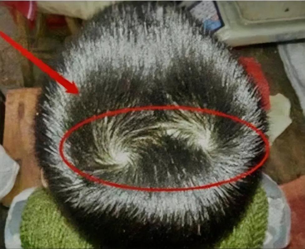 头漩涡不在正中间的原因