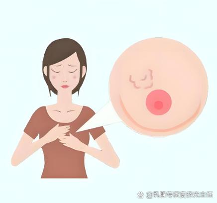 乳腺结节是怎么形成的