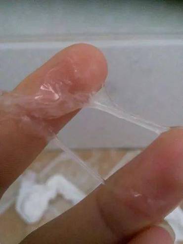 女性的白色分泌物是什么原因