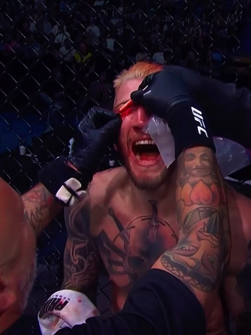 ufc在线观看高清免费