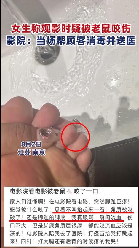 老鼠咬了裤子好不好